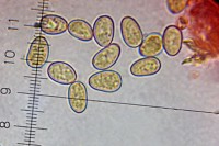 /album/fotogaleria-inocybe-dulcamara-/vytrusy-jpg2/