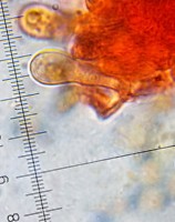 /album/fotogaleria-inocybe-dulcamara-/cheilocystidy-jpg1/