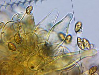 /album/fotogaleria-inocybe-phaeodisca/cheilocystidy-jpg7/