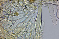 /album/fotogaleria-inocybe-phaeodisca/kaulocystidy-jpg7/