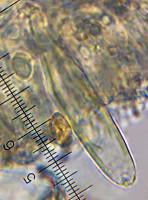 /album/fotogaleria-inocybe-sp-3/cheilocystidy-jpg8/