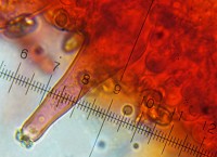 /album/fotogaleria-inocybe-sp-2/cheilocystidy-jpg15/