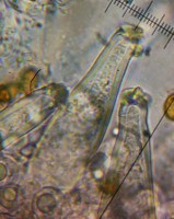 /album/fotogaleria-inocybe-sp-4/cheilocystidy-jpg16/