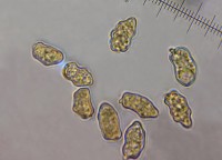 /album/fotogaleria-inocybe-sp-5/vytrusy-jpg19/