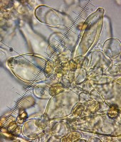 /album/fotogaleria-inocybe-sp-5/cheilocystidy-jpg17/