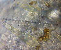 /album/inocybe-sp-1/cheilocystidy-jpg18/