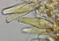 /album/inocybe-hirtella/cheilocystidy-jpg19/