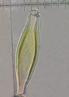 /album/inocybe-hirtella/pleurocystidy-jpg12/