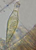 /album/inocybe-hirtella/kaulocystidy-jpg10/