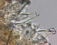 /album/inocybe-sp-2/cheilocystidy-jpg20/