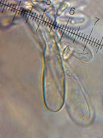 /album/inocybe-sp-2/kaulocystidy-jpg11/