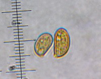 /album/inocybe-sp-2/vytrusy-jpg22/