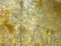 /album/fotogaleria-inocybe-haemacta/pleurocystidy-jpg14/
