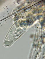 /album/fotogaleria-inocybe-haemacta/kaulocystidy-jpg12/